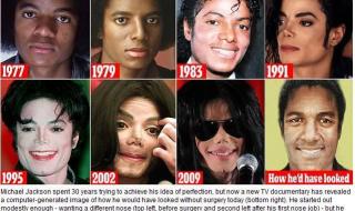 迈克尔杰克逊的皮肤