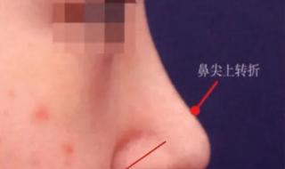 鼻头缩小要花多少钱